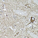 Immunohistochemistry - Anti-Calreticulin Antibody (A13022) - Antibodies.com