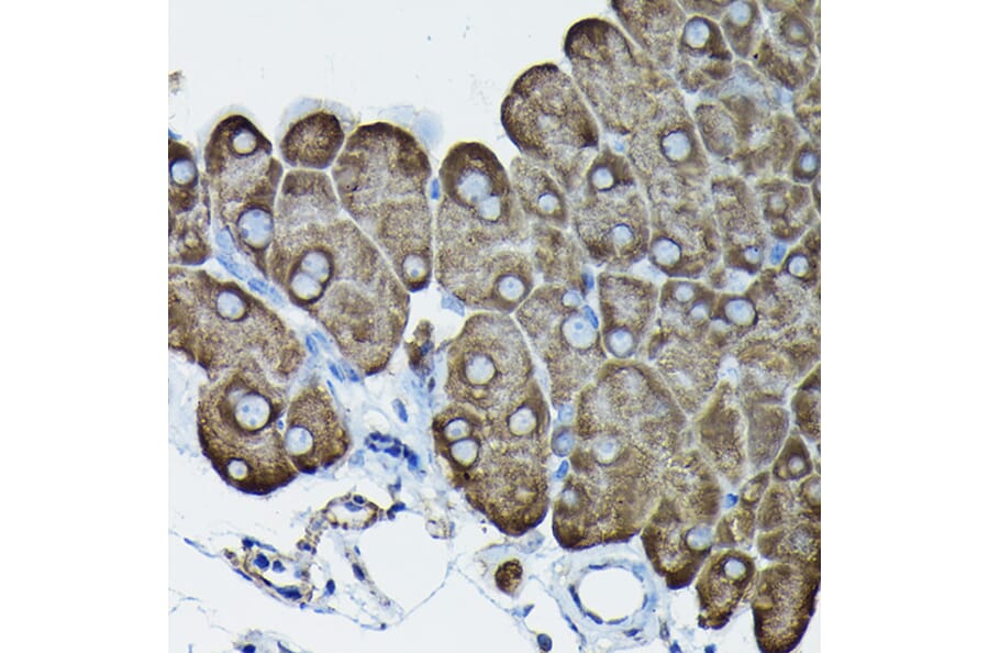 Immunohistochemistry - Anti-Calreticulin Antibody (A13022) - Antibodies.com