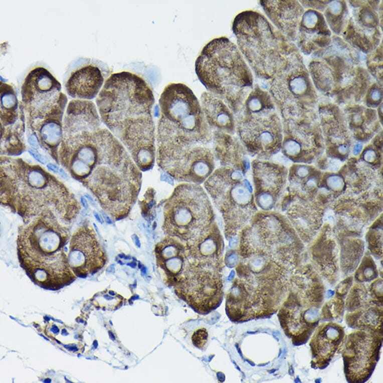 Immunohistochemistry - Anti-Calreticulin Antibody (A13022) - Antibodies.com