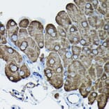 Immunohistochemistry - Anti-Calreticulin Antibody (A13022) - Antibodies.com