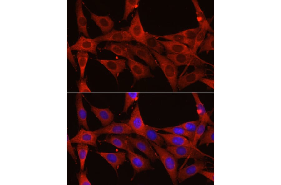Immunofluorescence - Anti-Calreticulin Antibody (A13022) - Antibodies.com
