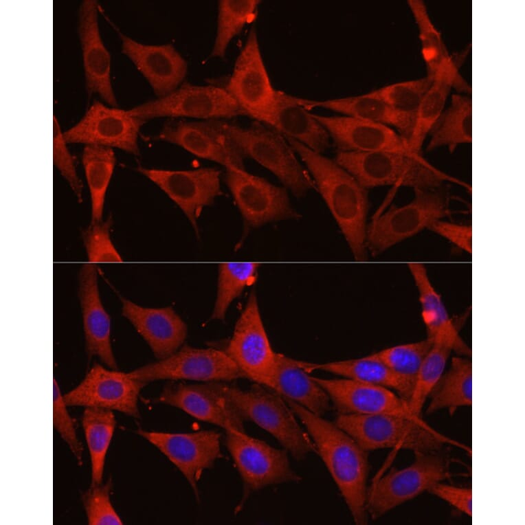 Immunofluorescence - Anti-Calreticulin Antibody (A13022) - Antibodies.com