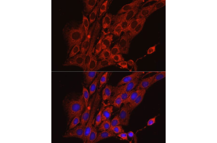 Immunofluorescence - Anti-Calreticulin Antibody (A13022) - Antibodies.com