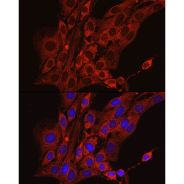Immunofluorescence - Anti-Calreticulin Antibody (A13022) - Antibodies.com
