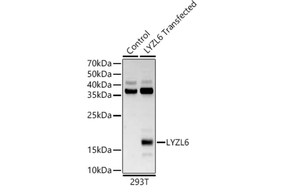 Western Blot - Anti-LYZL6 Antibody (A13023) - Antibodies.com