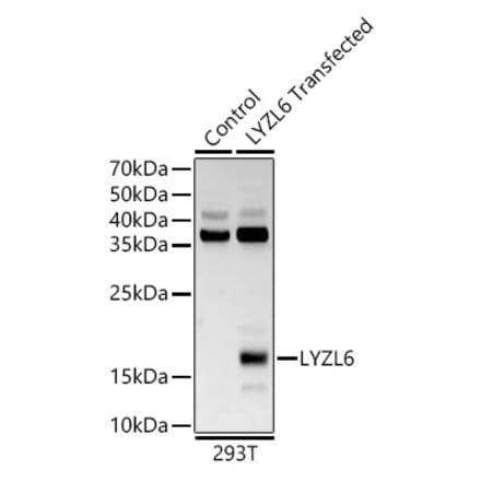 Western Blot - Anti-LYZL6 Antibody (A13023) - Antibodies.com