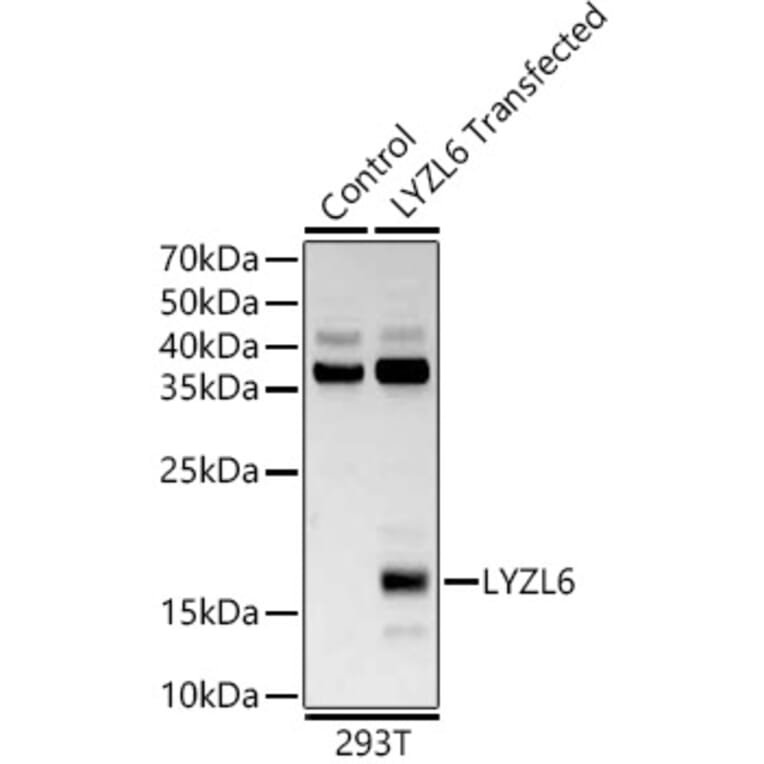 Western Blot - Anti-LYZL6 Antibody (A13023) - Antibodies.com