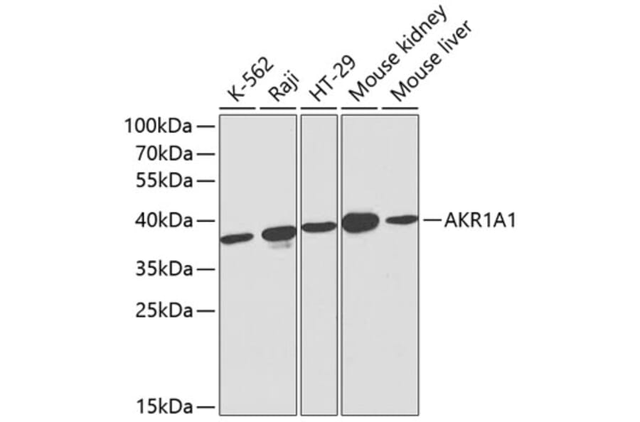 Western Blot - Anti-AKR1A1 Antibody (A13024) - Antibodies.com