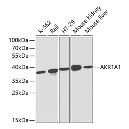 Western Blot - Anti-AKR1A1 Antibody (A13024) - Antibodies.com