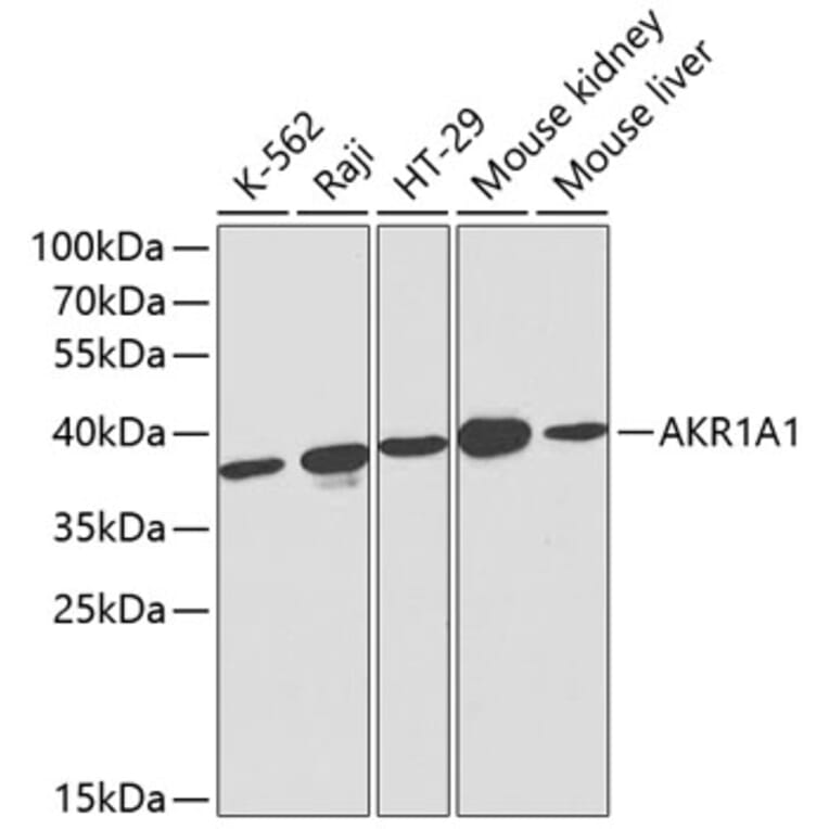 Western Blot - Anti-AKR1A1 Antibody (A13024) - Antibodies.com