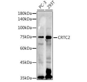 Western Blot - Anti-TORC2 Antibody (A13025) - Antibodies.com