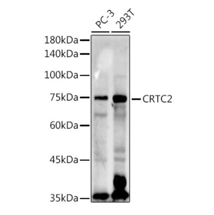 Western Blot - Anti-TORC2 Antibody (A13025) - Antibodies.com