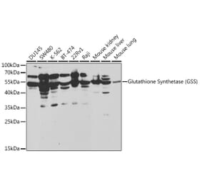 Western Blot - Anti-Glutathione Synthetase Antibody (A13026) - Antibodies.com