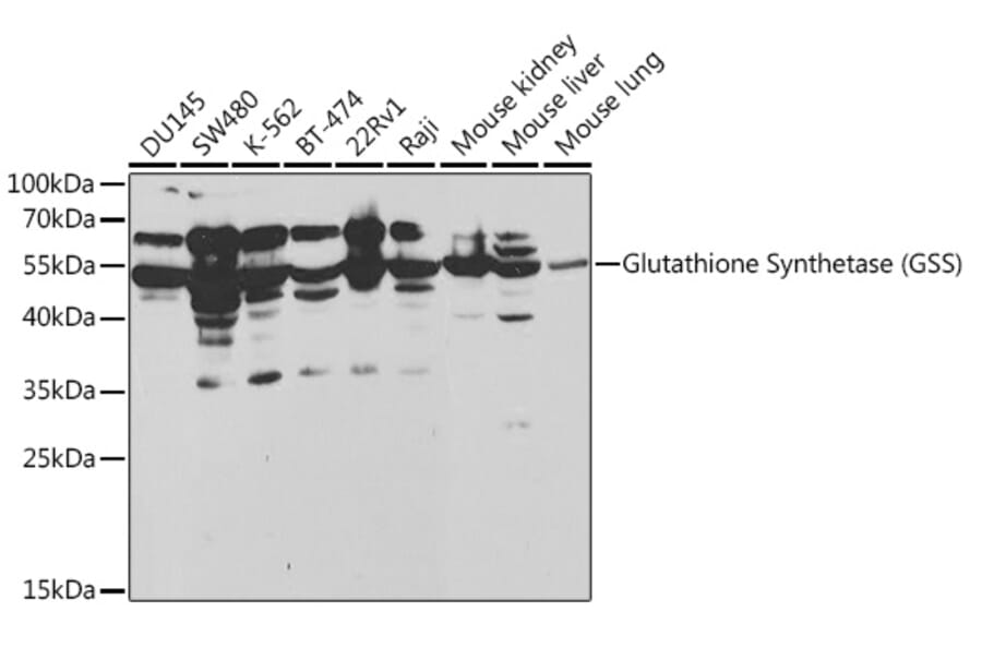 Western Blot - Anti-Glutathione Synthetase Antibody (A13026) - Antibodies.com