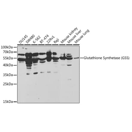 Western Blot - Anti-Glutathione Synthetase Antibody (A13026) - Antibodies.com