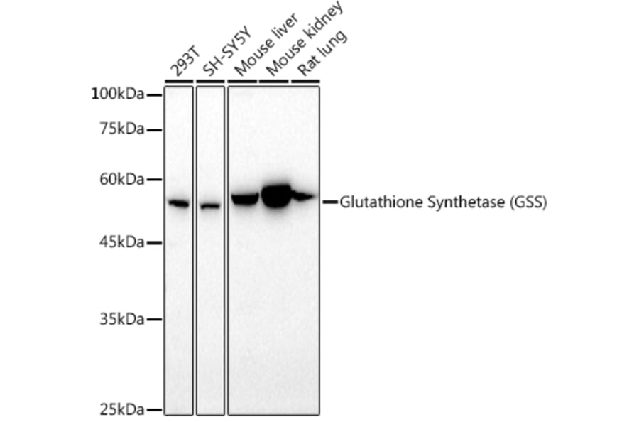 Western Blot - Anti-Glutathione Synthetase Antibody (A13026) - Antibodies.com