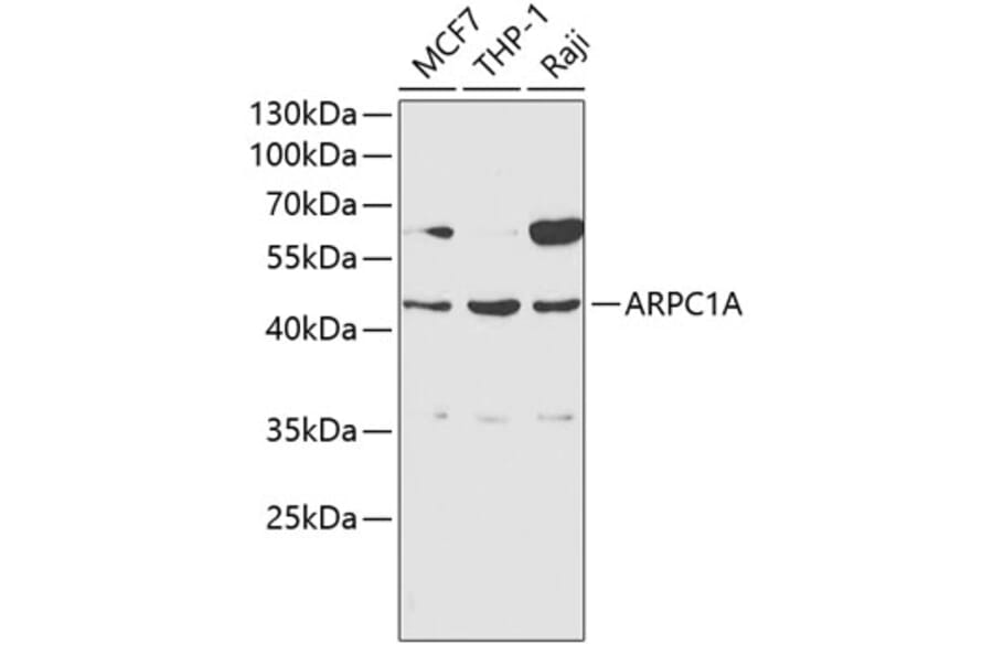 Western Blot - Anti-ARPC1A Antibody (A1070) - Antibodies.com