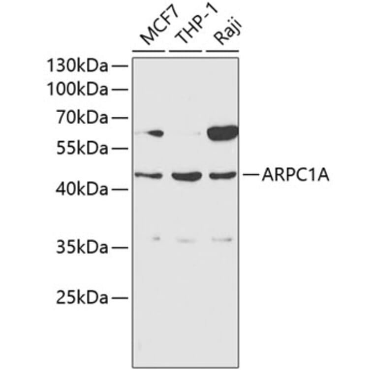 Western Blot - Anti-ARPC1A Antibody (A1070) - Antibodies.com