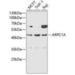 Western Blot - Anti-ARPC1A Antibody (A1070) - Antibodies.com