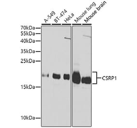 Western Blot - Anti-CSRP1 Antibody (A13028) - Antibodies.com