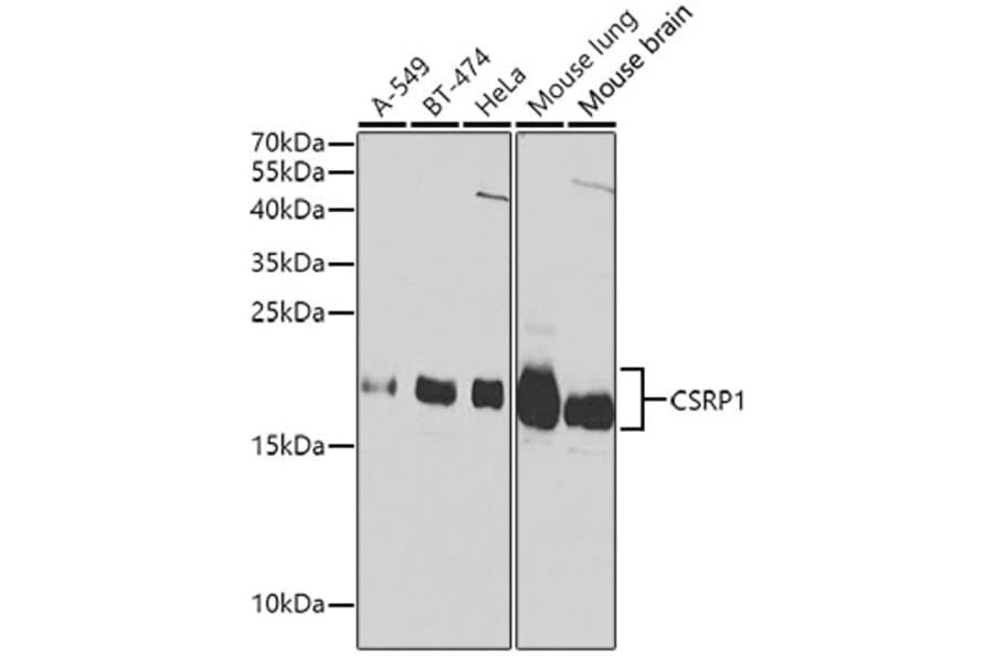 Western Blot - Anti-CSRP1 Antibody (A13028) - Antibodies.com