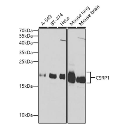 Western Blot - Anti-CSRP1 Antibody (A13028) - Antibodies.com