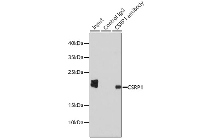 Western Blot - Anti-CSRP1 Antibody (A13028) - Antibodies.com