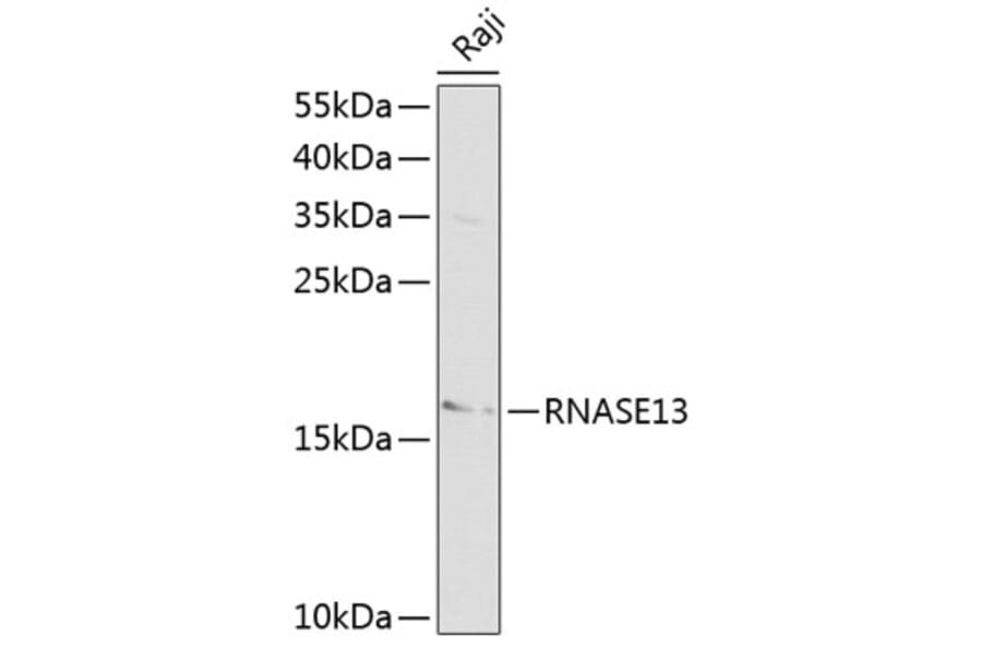 Western Blot - Anti-RNASE13 Antibody (A1073) - Antibodies.com