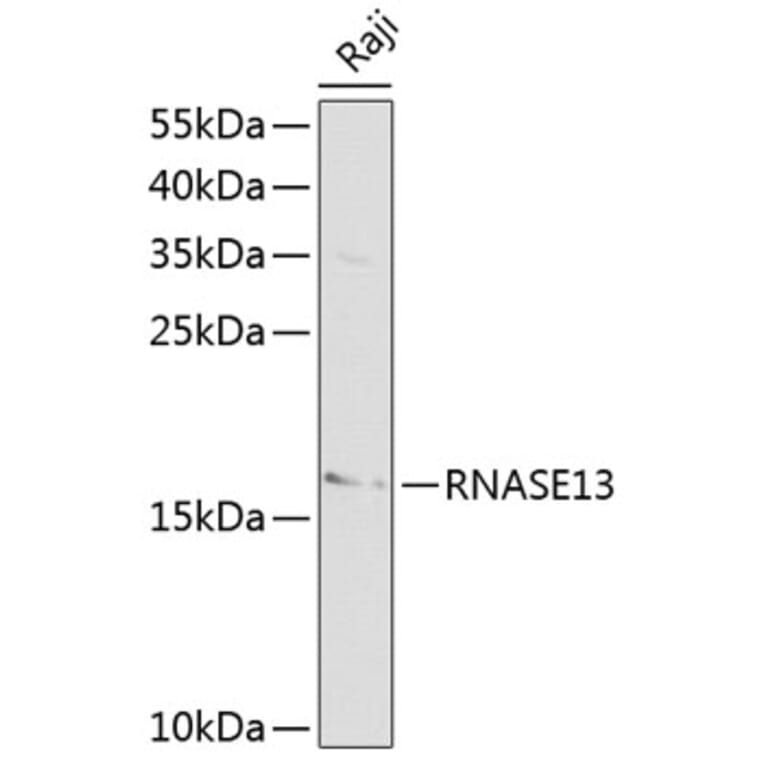 Western Blot - Anti-RNASE13 Antibody (A1073) - Antibodies.com