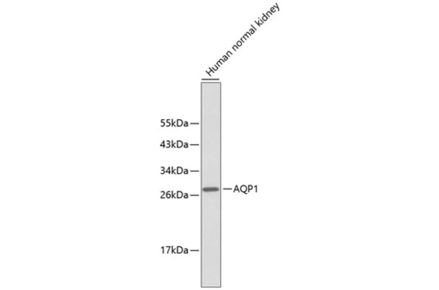 Western Blot - Anti-AQP1 Antibody (A10730) - Antibodies.com