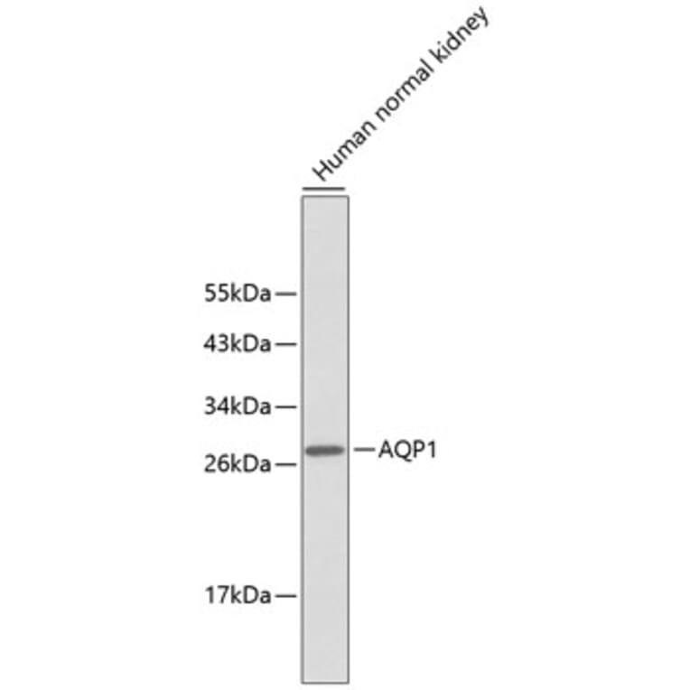 Western Blot - Anti-AQP1 Antibody (A10730) - Antibodies.com