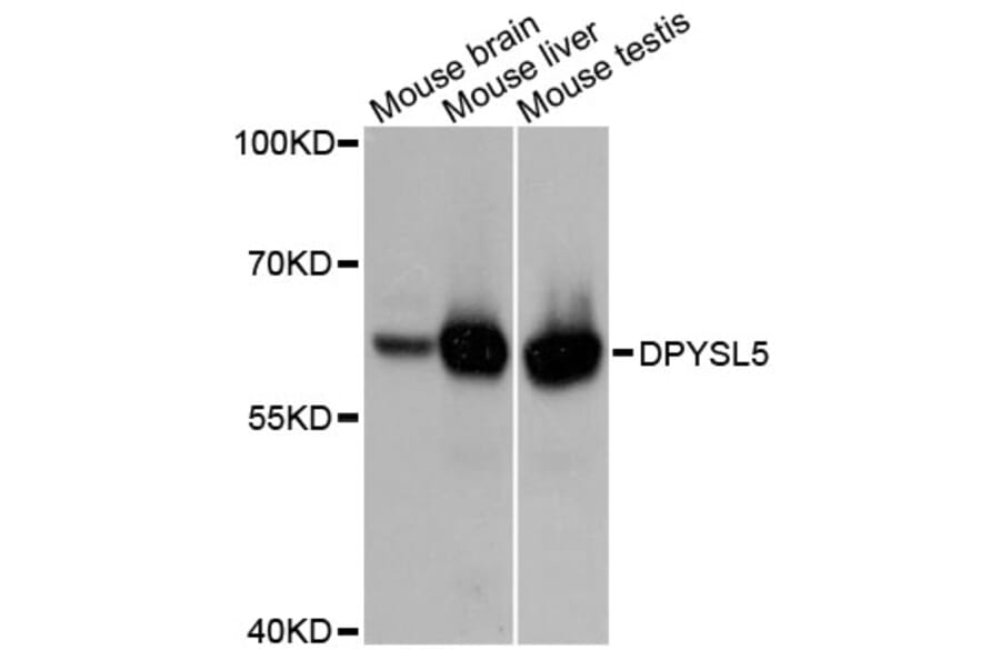 Western Blot - Anti-DPYSL5 Antibody (A10734) - Antibodies.com