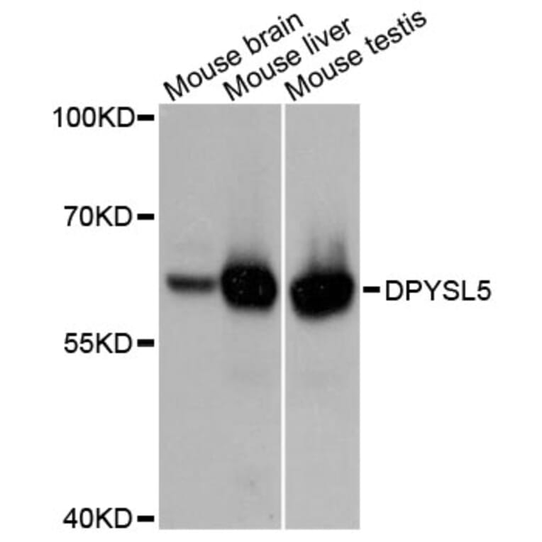 Western Blot - Anti-DPYSL5 Antibody (A10734) - Antibodies.com