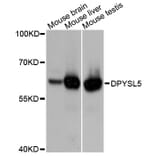 Western Blot - Anti-DPYSL5 Antibody (A10734) - Antibodies.com