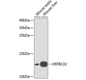 Western Blot - Anti-DEFB132 Antibody (A1074) - Antibodies.com