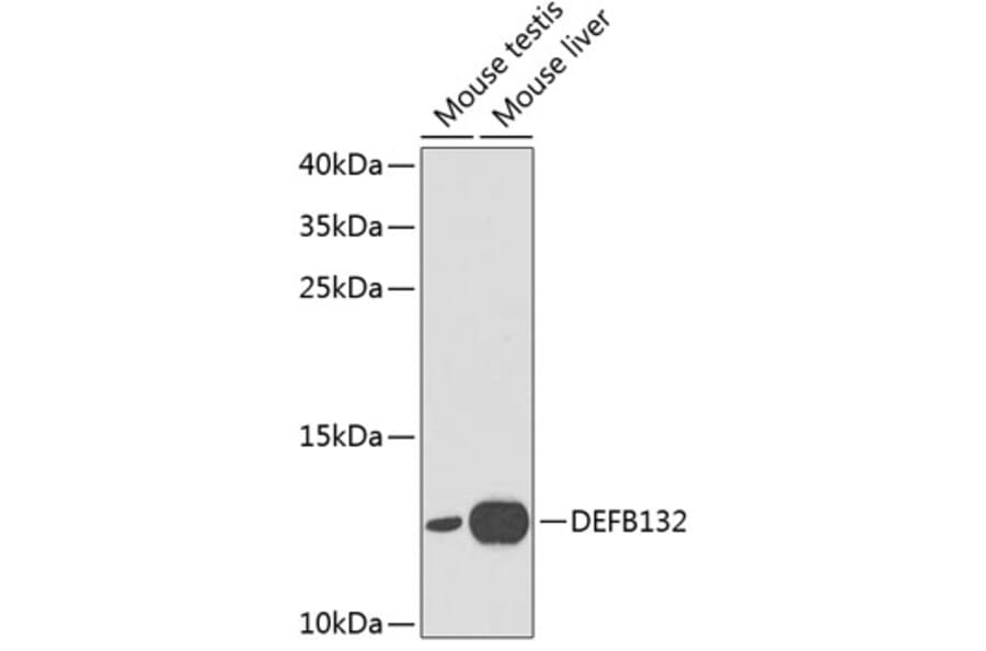 Western Blot - Anti-DEFB132 Antibody (A1074) - Antibodies.com