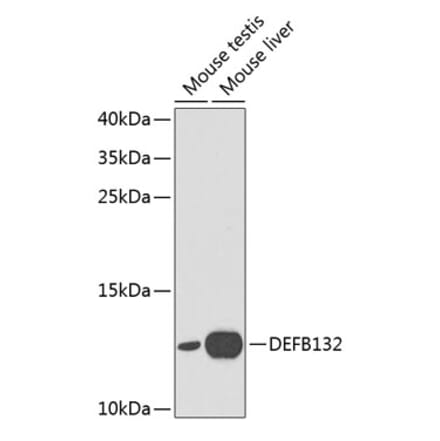 Western Blot - Anti-DEFB132 Antibody (A1074) - Antibodies.com