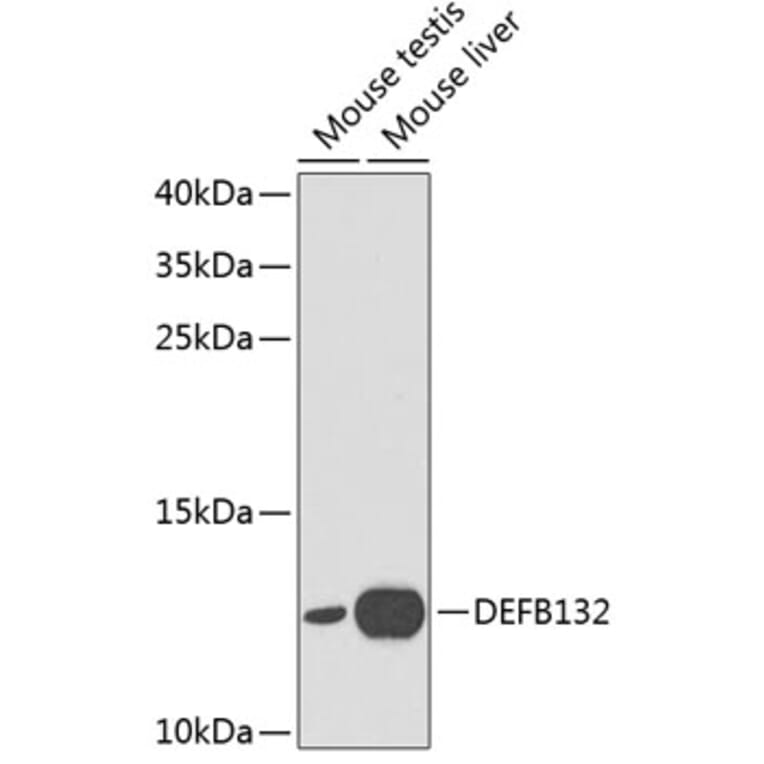 Western Blot - Anti-DEFB132 Antibody (A1074) - Antibodies.com