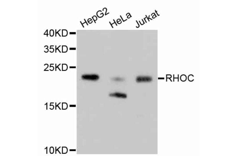 Western Blot - Anti-RHOA + RHOB + RHOC Antibody (A10741) - Antibodies.com