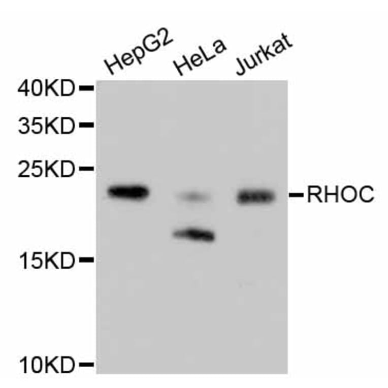 Western Blot - Anti-RHOA + RHOB + RHOC Antibody (A10741) - Antibodies.com