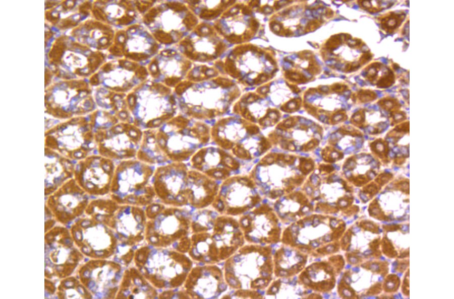Immunohistochemistry - Anti-RHOA + RHOB + RHOC Antibody (A10741) - Antibodies.com