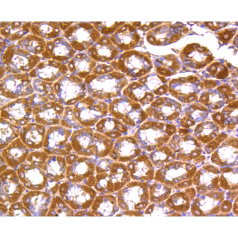 Immunohistochemistry - Anti-RHOA + RHOB + RHOC Antibody (A10741) - Antibodies.com