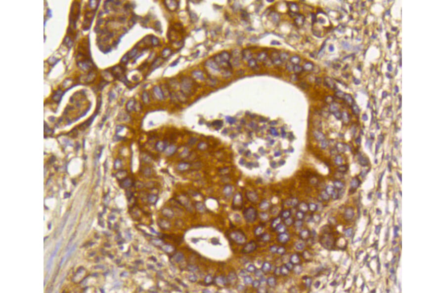 Immunohistochemistry - Anti-RHOA + RHOB + RHOC Antibody (A10741) - Antibodies.com