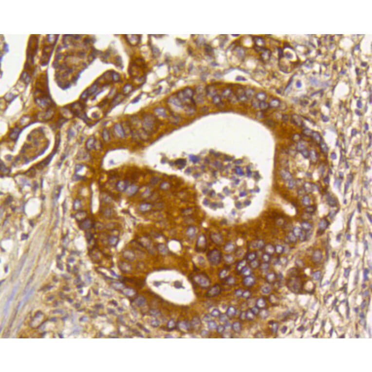 Immunohistochemistry - Anti-RHOA + RHOB + RHOC Antibody (A10741) - Antibodies.com
