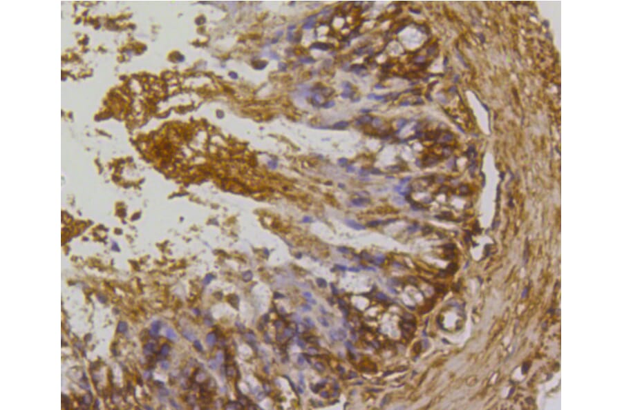 Immunohistochemistry - Anti-RHOA + RHOB + RHOC Antibody (A10741) - Antibodies.com