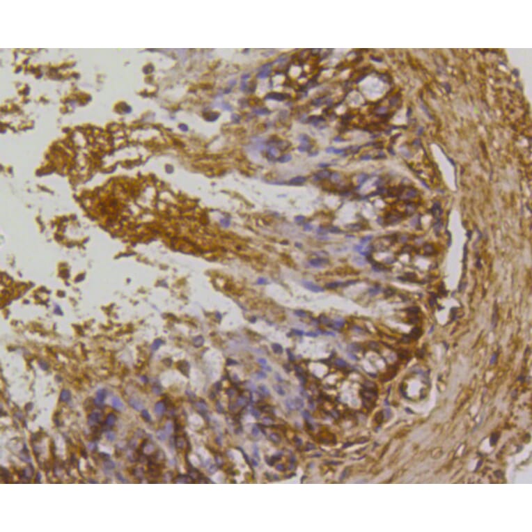 Immunohistochemistry - Anti-RHOA + RHOB + RHOC Antibody (A10741) - Antibodies.com