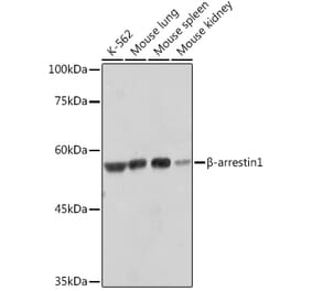 Western Blot - Anti-beta Arrestin 1 Antibody [ARC2370] (A13040) - Antibodies.com