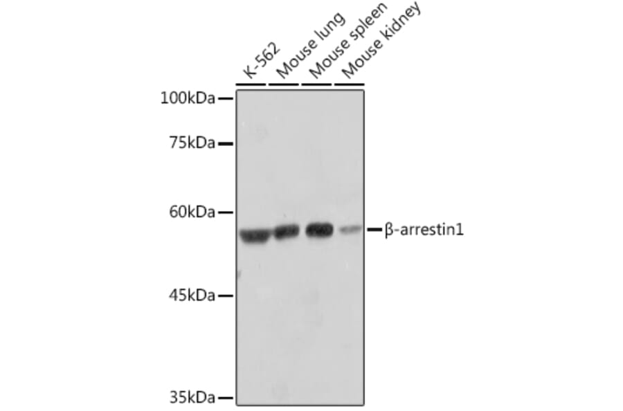 Western Blot - Anti-beta Arrestin 1 Antibody [ARC2370] (A13040) - Antibodies.com