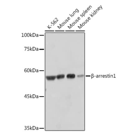 Western Blot - Anti-beta Arrestin 1 Antibody [ARC2370] (A13040) - Antibodies.com