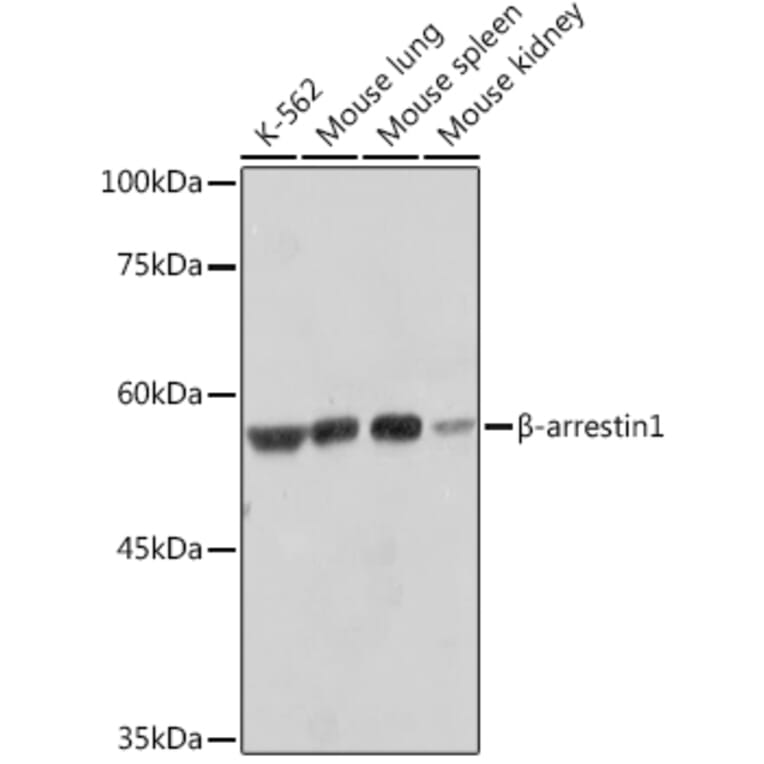 Western Blot - Anti-beta Arrestin 1 Antibody [ARC2370] (A13040) - Antibodies.com